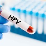 واکسن HPV ایرانی وارد بازار شد