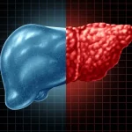 آیا شما هم علائم این بیماری مرگبار خاموش را دارید؟
