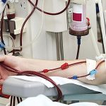 آیا همه مبتلایان به هموفیلی سابقه فامیلی دارند؟