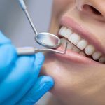 چرا تعرفه دندانپزشکی متغیر است؟ بررسی عوامل تأثیرگذار بر قیمت‌ها