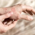روش ایمن استفاده از روغن نارگیل برای حساسیت پوستی