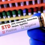 NHS نخستین واکسن سوزاک در جهان را عرضه می‌کند