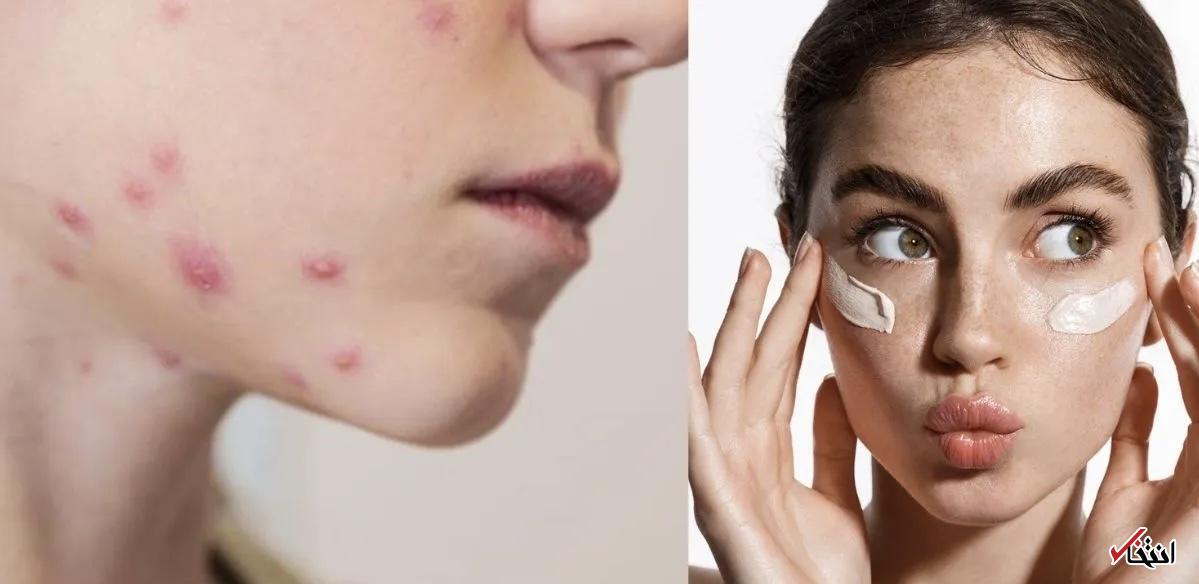 Wp Header Logo 93.png