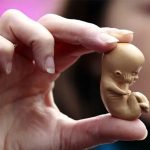 سقط‌های غیرقانونی چه عوارضی دارد؟